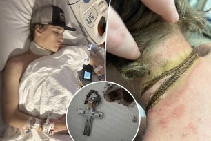 Oklahoma teen Rayce is lucky to be alive after his religious crucifix electrocuted him like a "hot coil," leaving his entire neck encircled in scars.